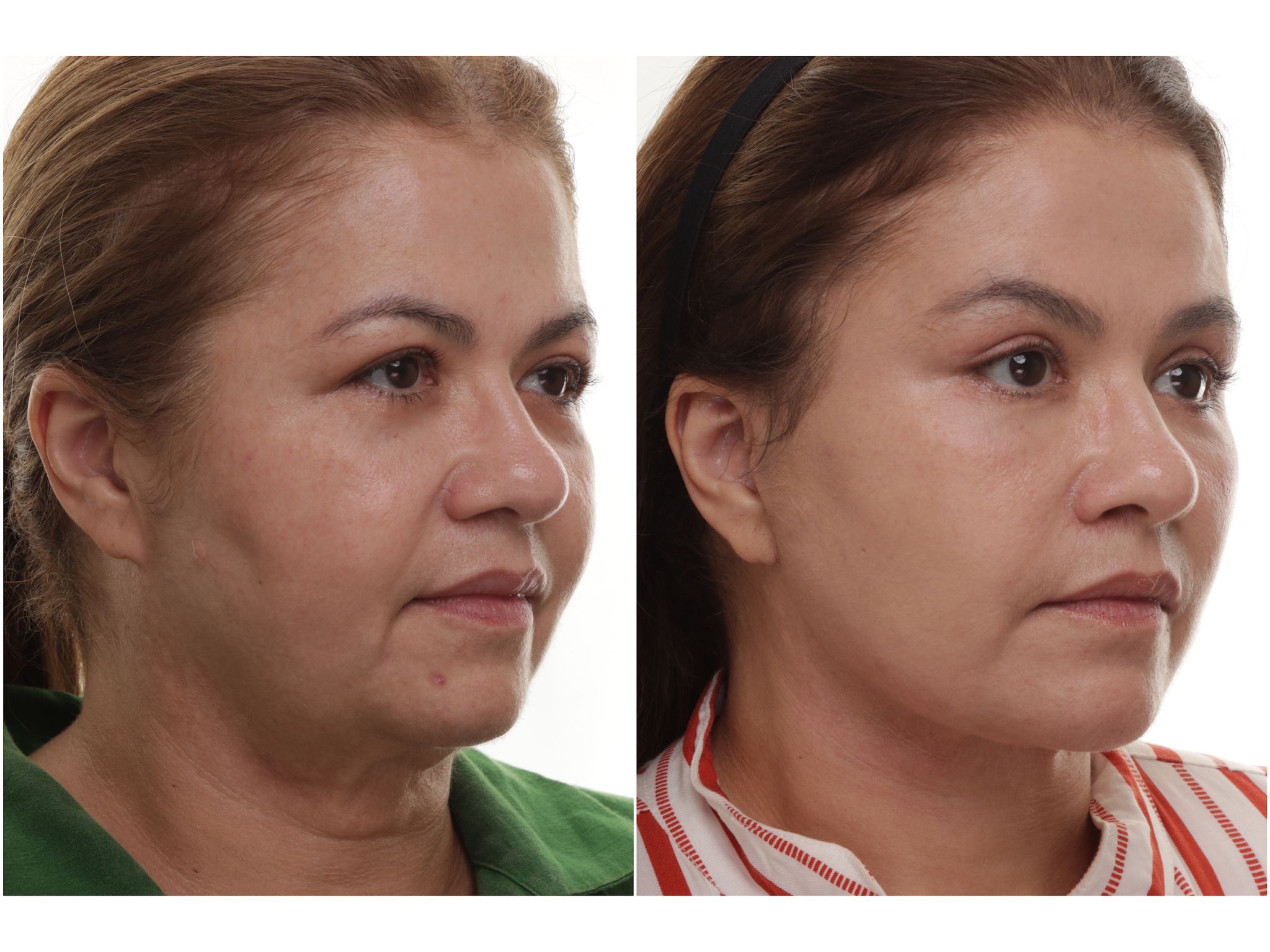 Foto 5 - Marcia Leite